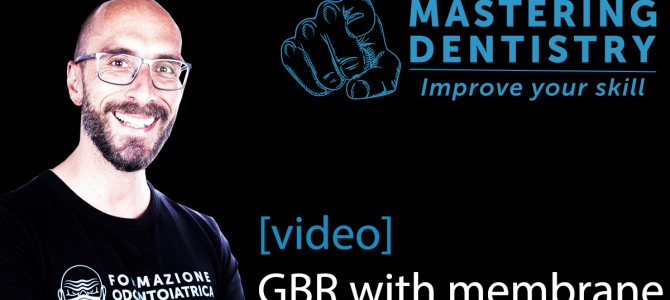 “[VIDEO] GUIDED BONE REGENERATION WITH A NEW RESORBABLE MAGNESIUM MEMBRANE… LET’S TRY IT!”